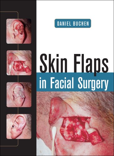 Skin Flaps in Facial Surgery   2007 9780071459433 Front Cover