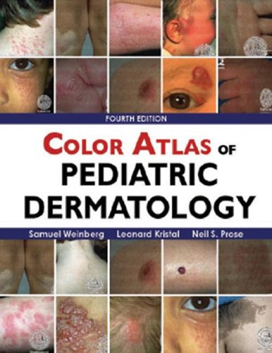 Color Atlas of Pediatric Dermatology  4th 2008 9780071455435 Front Cover
