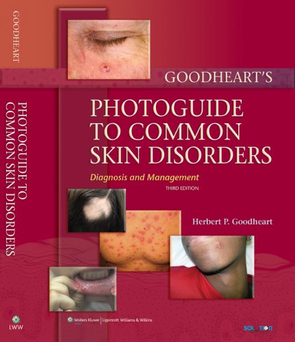 Goodheart's Photoguide to Common Skin Disorders Diagnosis and Management 3rd 2008 (Revised) 9780781771436 Front Cover