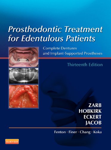 Prosthodontic Treatment for Edentulous Patients Complete Dentures and Implant-Supported Prostheses 13th 2013 9780323078443 Front Cover