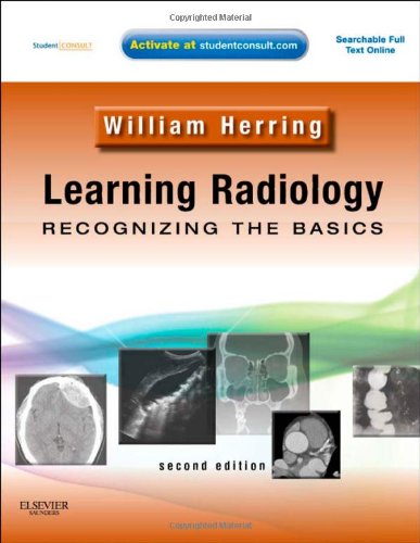 Learning Radiology Recognizing the Basics (with STUDENT CONSULT Online Access) 2nd 2012 9780323074445 Front Cover