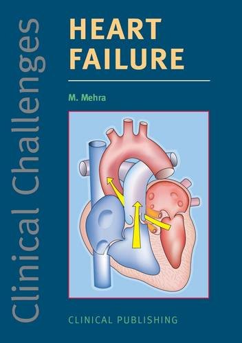 Clinical Challenges in Heart Failure   2009 9781846920448 Front Cover