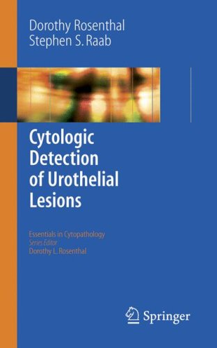 Cytologic Detection of Urothelial Lesions   2006 9780387239453 Front Cover