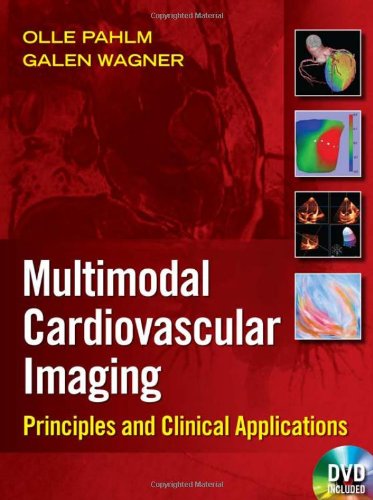 Multimodal Cardiovascular Imaging Principles and Clinical Applications  2011 9780071613460 Front Cover