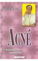 Acne: Un tratamiento naturista / A Naturist Treatment  2001 9789706434463 Front Cover