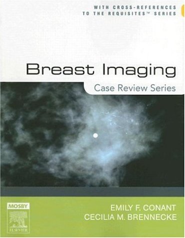 Breast Imaging   2006 9780323017466 Front Cover