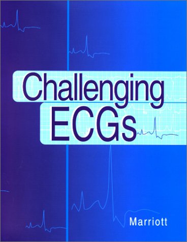 Challenging ECGs   2002 9781560535478 Front Cover