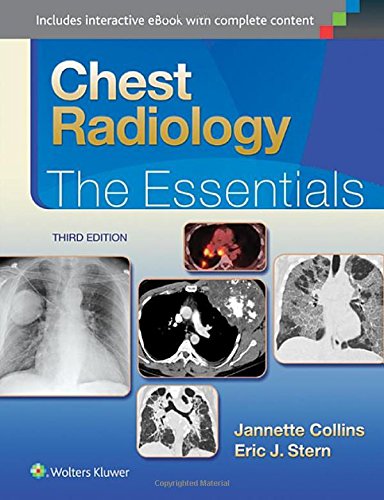 Chest Radiology: the Essentials  3rd 2015 (Revised) 9781451144482 Front Cover