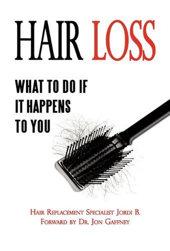 Hair Loss What to do if it Happens to You  2009 9781450203487 Front Cover