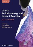 Clinical Periodontology and Implant Dentistry, 2 Volume Set  6th 2015 9780470672488 Front Cover