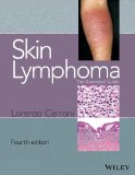 Skin Lymphoma The Illustrated Guide 4th 2014 9781118492499 Front Cover