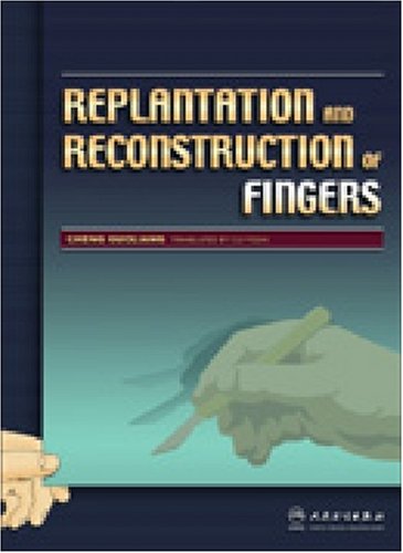 Replantation and Reconstruction of Fingers:  2008 9787117092524 Front Cover