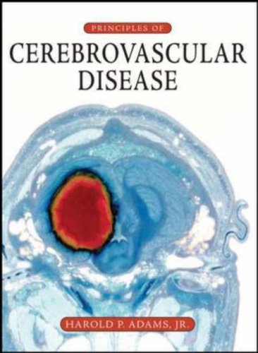 Principles of Cerebrovascular Disease   2007 9780071416535 Front Cover