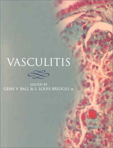 Vasculitis   2001 9780192630537 Front Cover