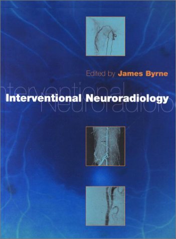 Interventional Neuroradiology Theory and Practice  2002 9780192631541 Front Cover