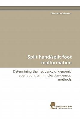 Split Hand/Split Foot Malformation N/A 9783838125541 Front Cover