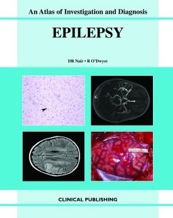 Epilepsy: An Atlas of Investigation and Management  2008 9781904392545 Front Cover