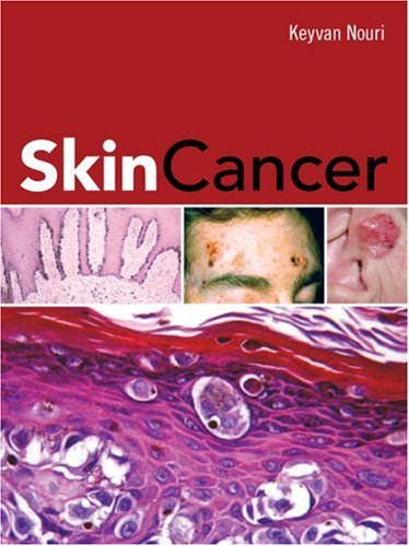 Skin Cancer   2008 9780071472562 Front Cover