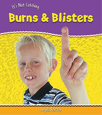 Burnes & Blisters:   2005 9780431021577 Front Cover