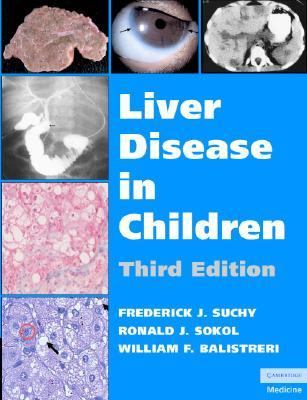 Liver Disease in Children  3rd 2007 (Revised) 9780521856577 Front Cover