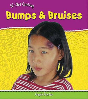 Bumps & Bruises:   2005 9780431021584 Front Cover