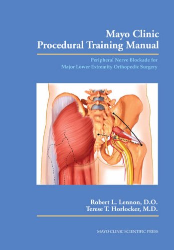 Mayo Clinic Procedural Training Manual Peripheral Nerve Blockade for Major Lower Extremity Orthopedic Surgery  2006 9780849390586 Front Cover