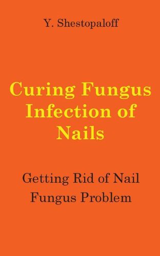 Curing Fungus Infection of Nails: Getting Rid of Nail Fungus Problem  2013 9780987778598 Front Cover