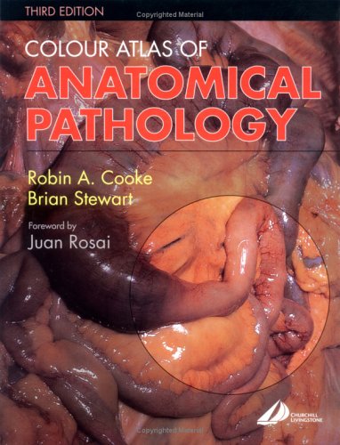 Colour Atlas of Anatomical Pathology  3rd 2004 (Revised) 9780443073601 Front Cover