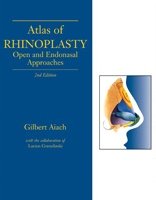 Atlas of Rhinoplasty Open and Endonasal Approaches 2nd 2003 (Revised) 9781576261606 Front Cover