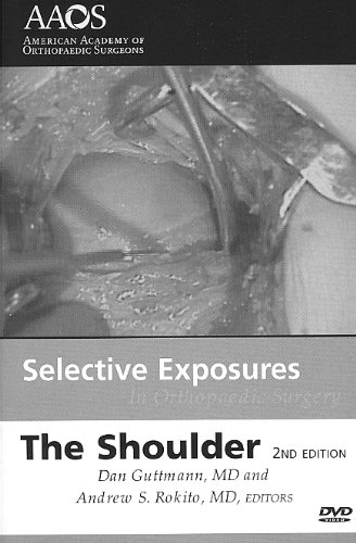 SELECTIVE EXPOSURES IN ORTHOPAEDIC SURGERY: The Shoulder  2007 9780892034611 Front Cover