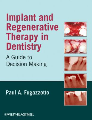 Implant and Regenerative Therapy in Dentistry A Guide to Decision Making  2009 9780813829623 Front Cover