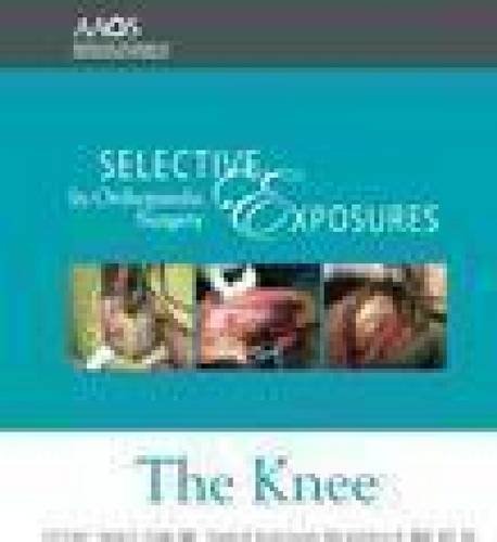 Selective Exposures in Orthopaedic Surgery: The Knee  2011 9780892037629 Front Cover