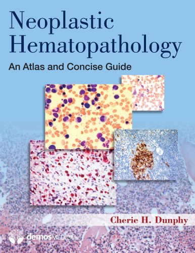 Neoplastic Hemapathology:   2012 9781936287635 Front Cover