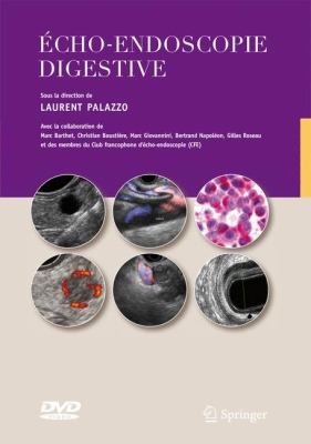 Echo-Endoscopie Digestive Avec la Collaboration des Membres du Club Francophone D'ï¿½cho-Endoscopie  2012 9782287991639 Front Cover