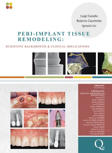 Peri-Implant Tissue Remodeling: Scientific Background and Clinical Implications   2012 9788874921669 Front Cover