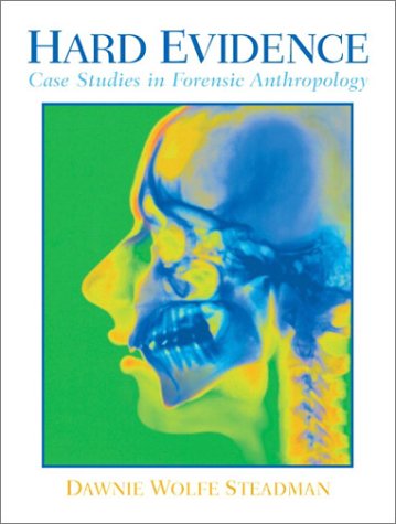 Hard Evidence Case Studies in Forensic Anthropology  2003 9780130305671 Front Cover