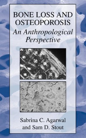 Bone Loss and Osteoporosis An Anthropological Perspective  2003 9780306477676 Front Cover
