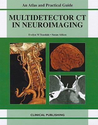 MDCT in Neuroimaging: An Atlas of Investigation and Diagnosis  2008 9781904392682 Front Cover