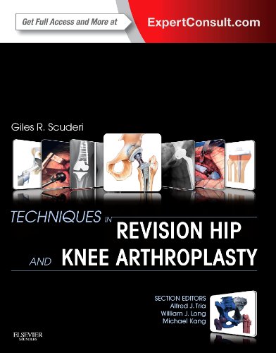 Techniques in Revision Hip and Knee Arthroplasty   2015 9781455723683 Front Cover