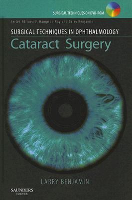 Cataract Surgery   2007 9781416029694 Front Cover