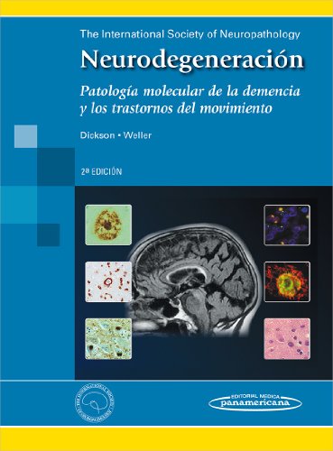 Neurodegeneracion / Neurodegeneration: Patologia Molecular De La Demencia Y Los Trastornos Del Movimiento / Molecular Pathology of Dementia and Movement Disorders  2012 9788498355697 Front Cover