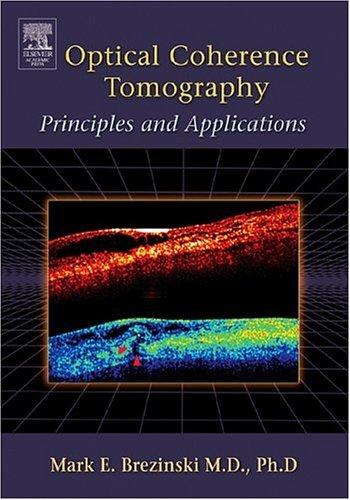 Optical Coherence Tomography Principles and Applications  2006 9780121335700 Front Cover