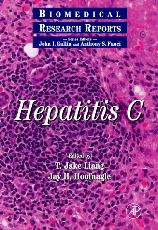 Hepatitis C   2000 9780124478701 Front Cover