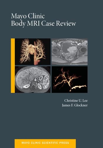 Mayo Clinic Body MRI Case Review   2014 9780199915705 Front Cover