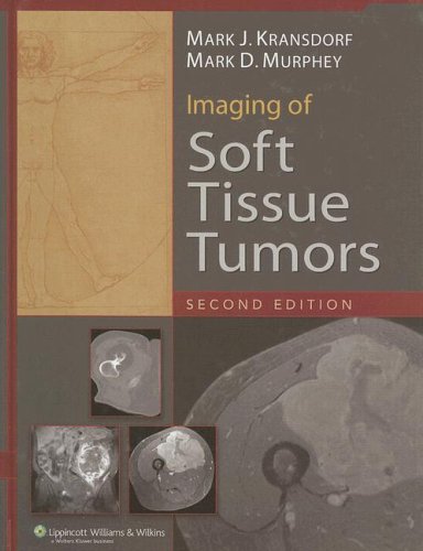 Imaging of Soft Tissue Tumors  2nd 2006 (Revised) 9780781747714 Front Cover