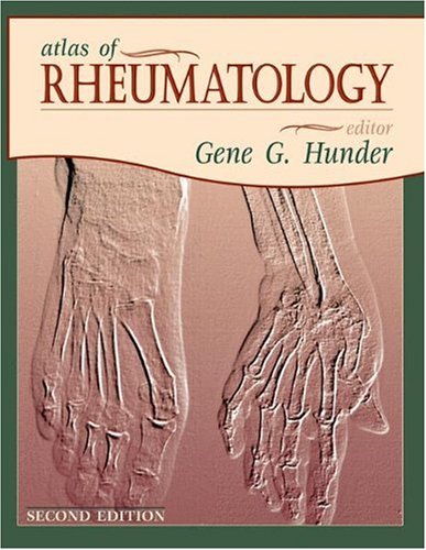 Atlas of Rheumatology  2nd 2001 9781573401715 Front Cover