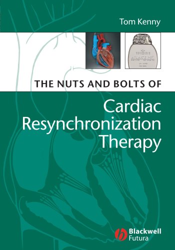 Nuts and Bolts of Cardiac Resynchronization Therapy   2007 9781405153720 Front Cover