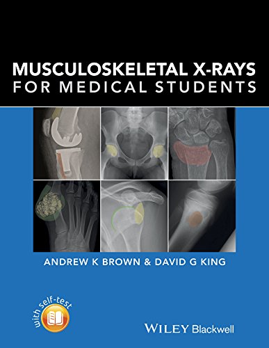 Musculoskeletal X-Rays for Medical Students and Trainees   2015 9781118458730 Front Cover