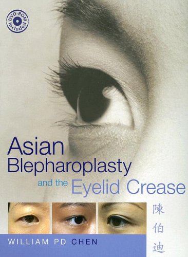 Asian Blepharoplasty and the Eyelid Crease  2nd 2006 (Revised) 9780750675741 Front Cover