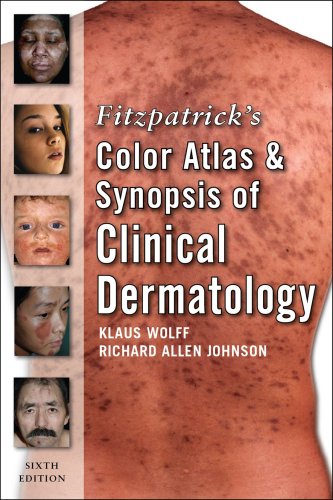Color Atlas and Synopsis of Clinical Dermatology  6th 2009 9780071599757 Front Cover